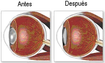 Actividad Física para Discapacitados