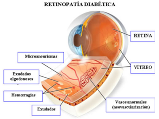 Actividad Física para Discapacitados