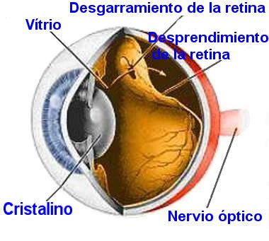 Actividad Física para Discapacitados