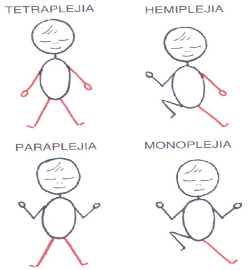 Actividad Física para Discapacitados