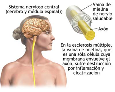 Actividad Física para Discapacitados