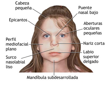 Actividad Física para Discapacitados