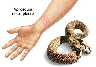 Socorrismo mordeduras de serpientes